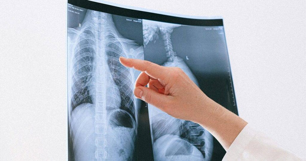 skupstina tk odobrila izmjene finansijskog plana zzo tk uvedena aba terapija